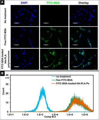 Enzyme-responsive polymersomes ameliorate autophagic failure in a cellular model of GM1 gangliosidosis